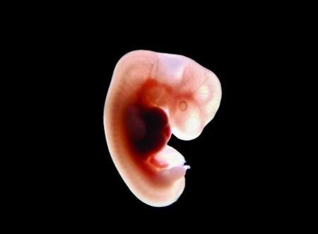 للحامل.. تعرفي على شكل الجنين في الشهر الأول | بوابة أخبار اليوم الإلكترونية